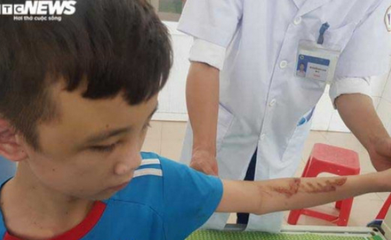 X&acirc;m hại, bạo h&agrave;nh trẻ em: Cần ti&ecirc;u ch&iacute; gi&aacute;m định tổn thương cả về mặt tinh thần