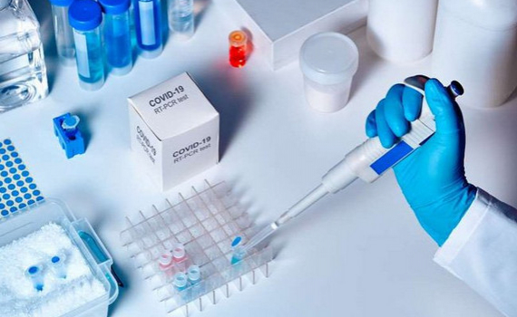 X&eacute;t nghiệm ph&aacute;t hiện SARS-CoV-2: Những vấn đề cần quan t&acirc;m