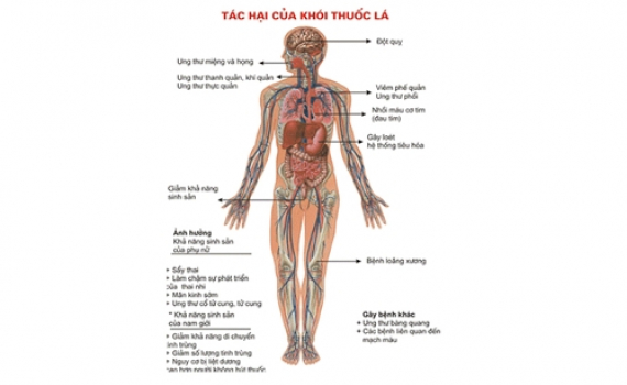 Việt Nam l&agrave; một trong những nước c&oacute; tỷ lệ nam giới h&uacute;t thuốc l&aacute; cao nhất thế giới
