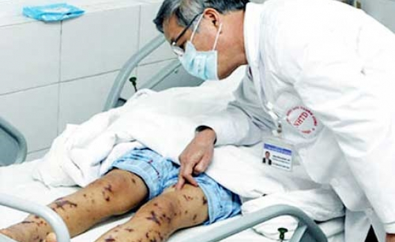 Bộ Y tế đề xuất 8 bệnh truyền nhiễm nh&oacute;m B được ưu ti&ecirc;n bố tr&iacute; ng&acirc;n s&aacute;ch kh&aacute;m chữa bệnh