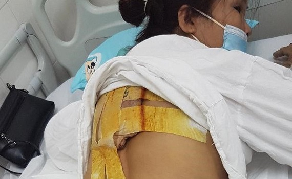 Biến chứng nguy hiểm từ việc d&ugrave;ng thuốc kh&ocirc;ng đ&uacute;ng c&aacute;ch