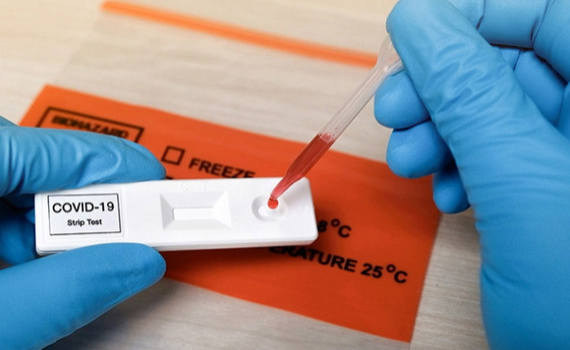 X&eacute;t nghiệm nhanh dương t&iacute;nh SARS-CoV-2 tại nh&agrave;, người d&acirc;n kh&ocirc;ng tự &yacute; đến bệnh viện