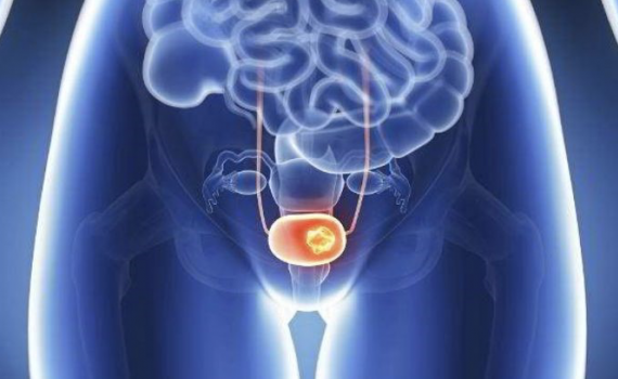 Tiểu ra máu, tiểu buốt có thể cảnh báo bệnh nguy hiểm - Báo ...