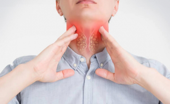 Những dấu hiệu nhận biết sớm gi&uacute;p điều trị bệnh ung thư v&ograve;m họng giai đoạn 2