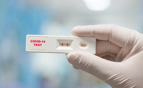 Y&ecirc;u cầu Bộ Y tế th&ocirc;ng tin về việc kit x&eacute;t nghiệm ph&aacute;t hiện Omicron 