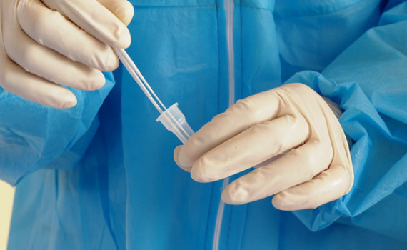 Cập nhật t&igrave;nh h&igrave;nh dịch Covid-19 tại Ninh B&igrave;nh ng&agrave;y 19/1