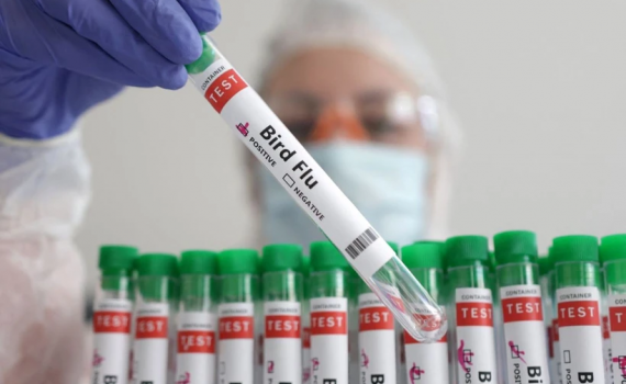 Mỹ ghi nhận ca tử vong đầu ti&ecirc;n do c&uacute;m gia cầm H5N1