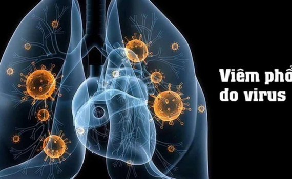 Tổ chức Y tế thế giới th&ocirc;ng tin về bệnh do virus g&acirc;y vi&ecirc;m phổi ở Trung Quốc