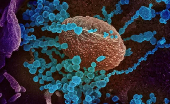 Dịch c&uacute;m Nga c&aacute;ch đ&acirc;y hơn 130 năm c&oacute; thể do virus corona g&acirc;y ra
