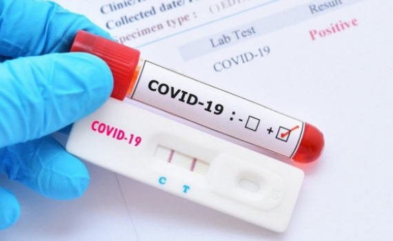 Loạn kit test, thuốc điều trị Covid-19