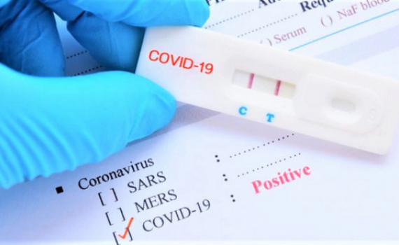 Sớm đưa kit test Covid-19 v&agrave;o diện b&igrave;nh ổn gi&aacute; 