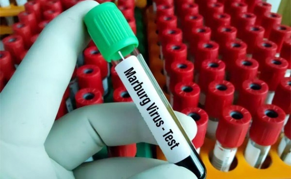 Việt Nam chủ động ph&ograve;ng, chống virus Marburg, d&ugrave; khả năng l&acirc;y lan thấp