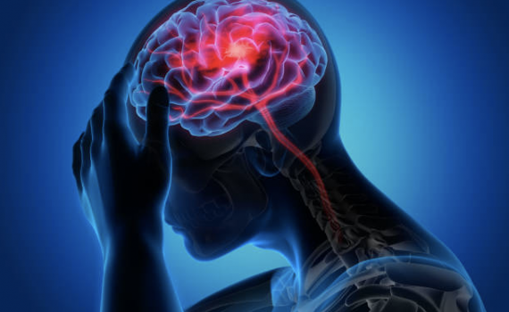 6 điều cần l&agrave;m v&agrave; 3 điều n&ecirc;n tr&aacute;nh đối với bệnh nh&acirc;n đột quỵ