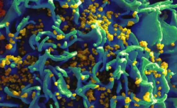 Sắp thử nghiệm l&acirc;m s&agrave;ng vaccine ngừa HIV