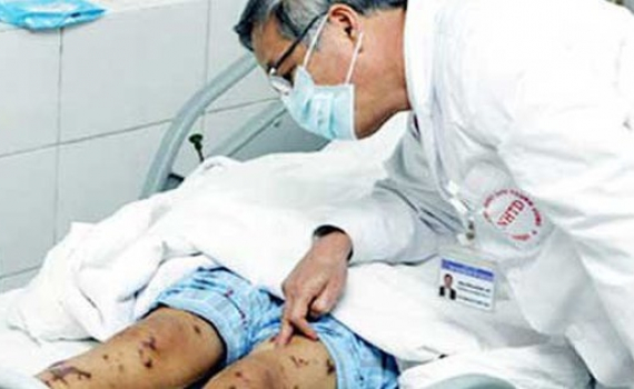 Bộ Y tế khuyến c&aacute;o c&aacute;c biện ph&aacute;p ph&ograve;ng l&acirc;y nhiễm li&ecirc;n cầu lợn sang người