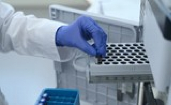C&ocirc;ng nghệ ph&aacute;t hiện virus SARS-CoV-2 trong 5 ph&uacute;t