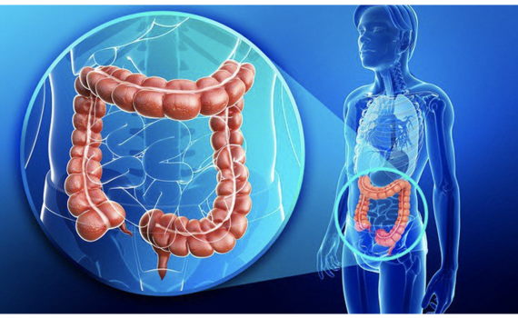 Những dấu hiệu cho biết bạn bị ung thư đại trực tr&agrave;ng