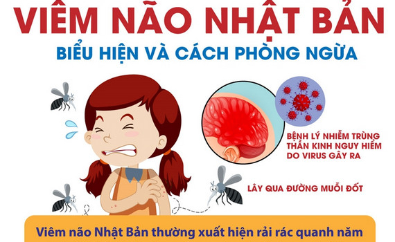 Vi&ecirc;m n&atilde;o Nhật Bản: Biểu hiện v&agrave; c&aacute;ch ph&ograve;ng ngừa