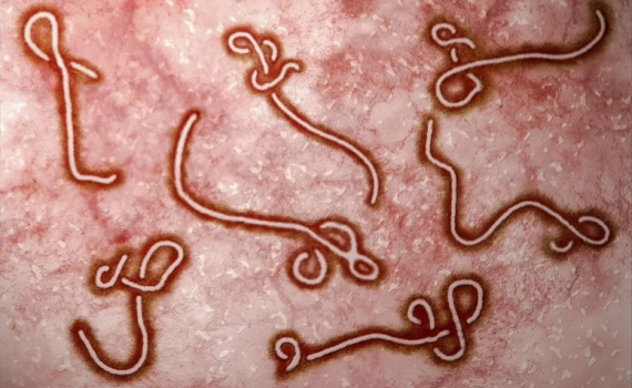 WHO b&aacute;o động khẩn về Ebola ở ch&acirc;u Phi, Việt Nam tăng gi&aacute;m s&aacute;t cửa khẩu