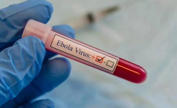 Tăng cường ph&ograve;ng chống Ebola, lưu &yacute; trường hợp nhập cảnh từ nước c&oacute; dịch trong 21 ng&agrave;y