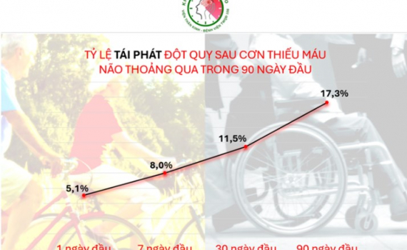 B&aacute;c sĩ cảnh b&aacute;o đột quỵ nguy hiểm từ cơn thiếu m&aacute;u n&atilde;o tho&aacute;ng qua
