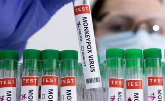 Thế giới khan hiếm vaccine đậu m&ugrave;a khỉ
