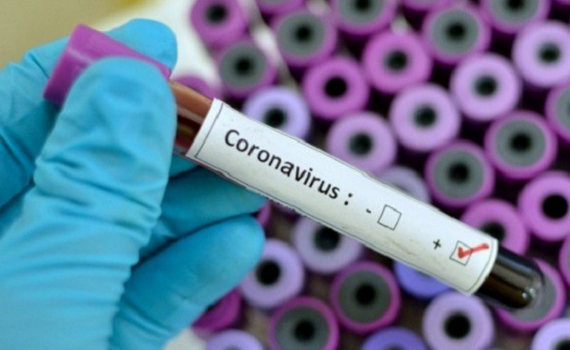 Số ca tử vong v&igrave; Covid-19 c&oacute; thể l&ecirc;n đến 2 triệu trước khi vaccine được d&ugrave;ng to&agrave;n cầu
