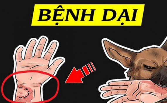 Bộ Y tế cảnh b&aacute;o nguy cơ b&ugrave;ng ph&aacute;t bệnh dại