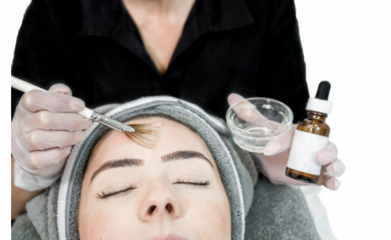 C&oacute; n&ecirc;n tự &yacute; thực hiện peel da tại nh&agrave;?