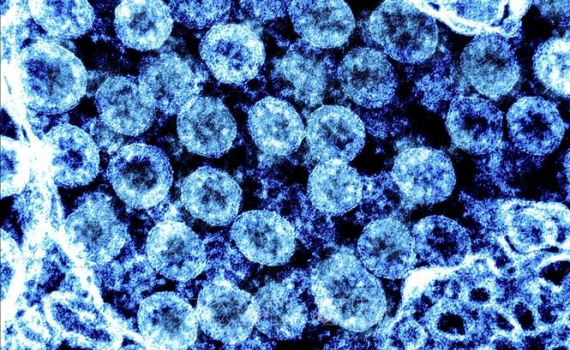 Đức ph&aacute;t hiện biến thể BA.2.86 của virus SARS-CoV-2