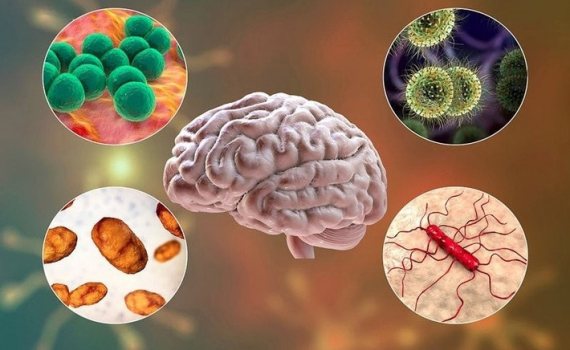 Gia tăng trường hợp trẻ em mắc bệnh vi&ecirc;m m&agrave;ng n&atilde;o do Enterovirus